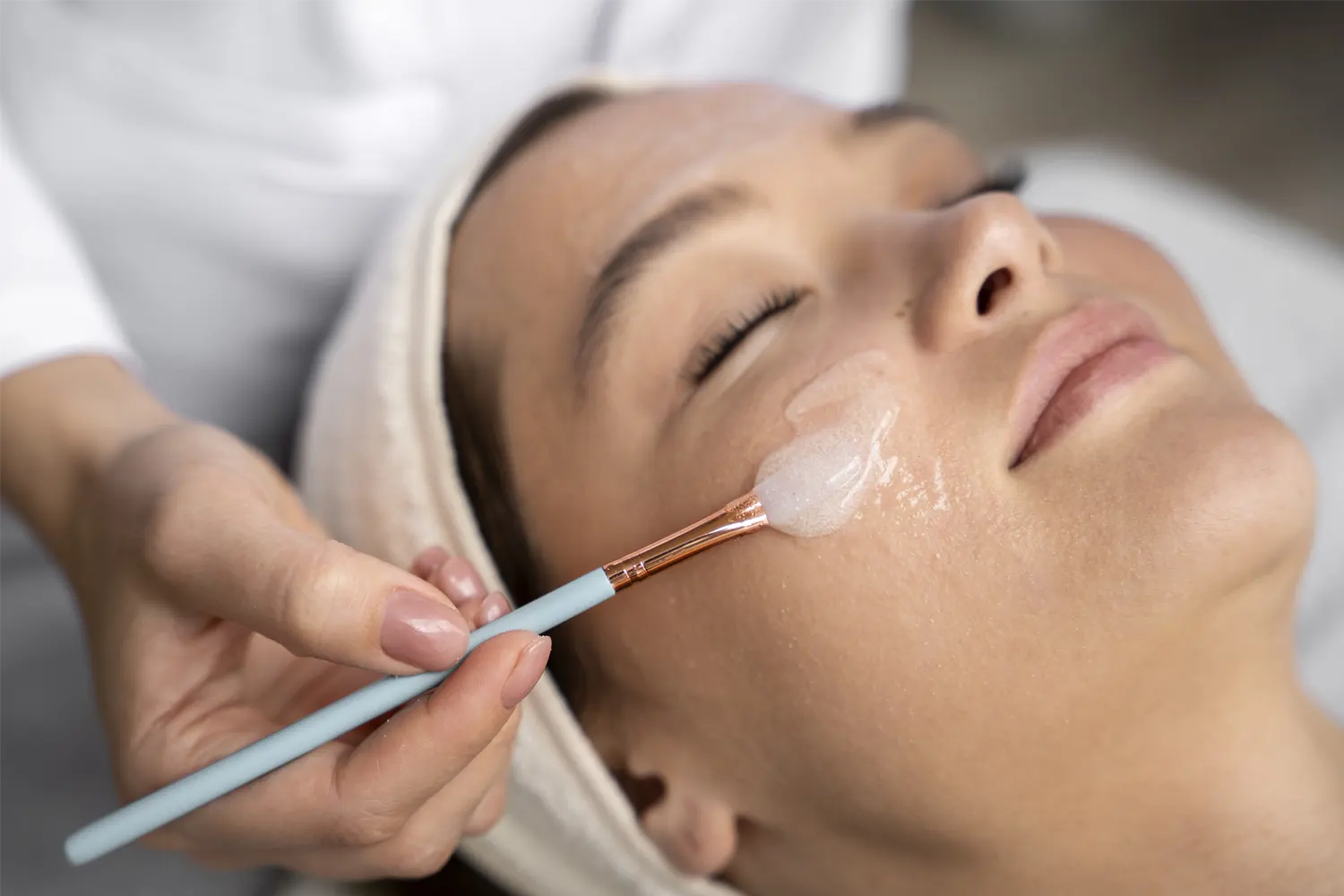 Peeling Facial ,limpieza facial